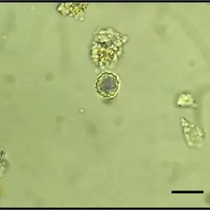 Phytoliths: What They Are and What They Tell Us